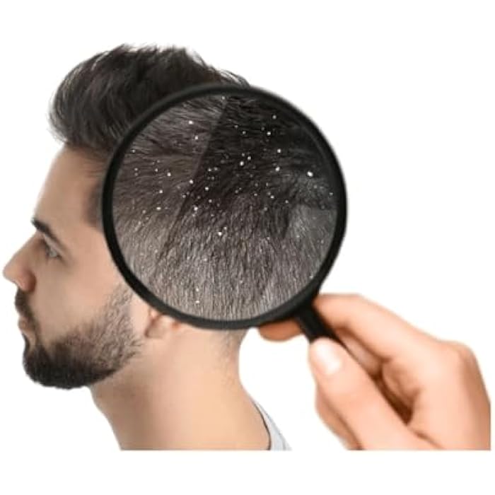 Shampoo (Sanus Hair) Shampoo Effective Anti Dandruff Oil Inflammation Scalp Irritation 300ml - Suitable for All Hair Types I from Al Shabrawini Pharmacy - Image 2